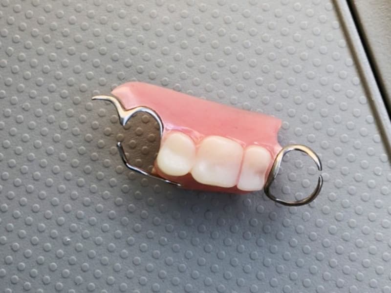 保険適用の入れ歯