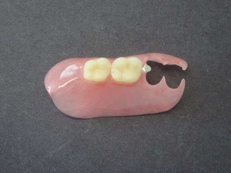 自費負担の入れ歯